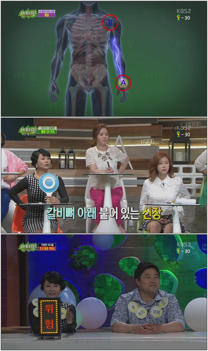 비타민.E536.140514.통증.HDTV.H264.720p-LIMO.avi.jpg