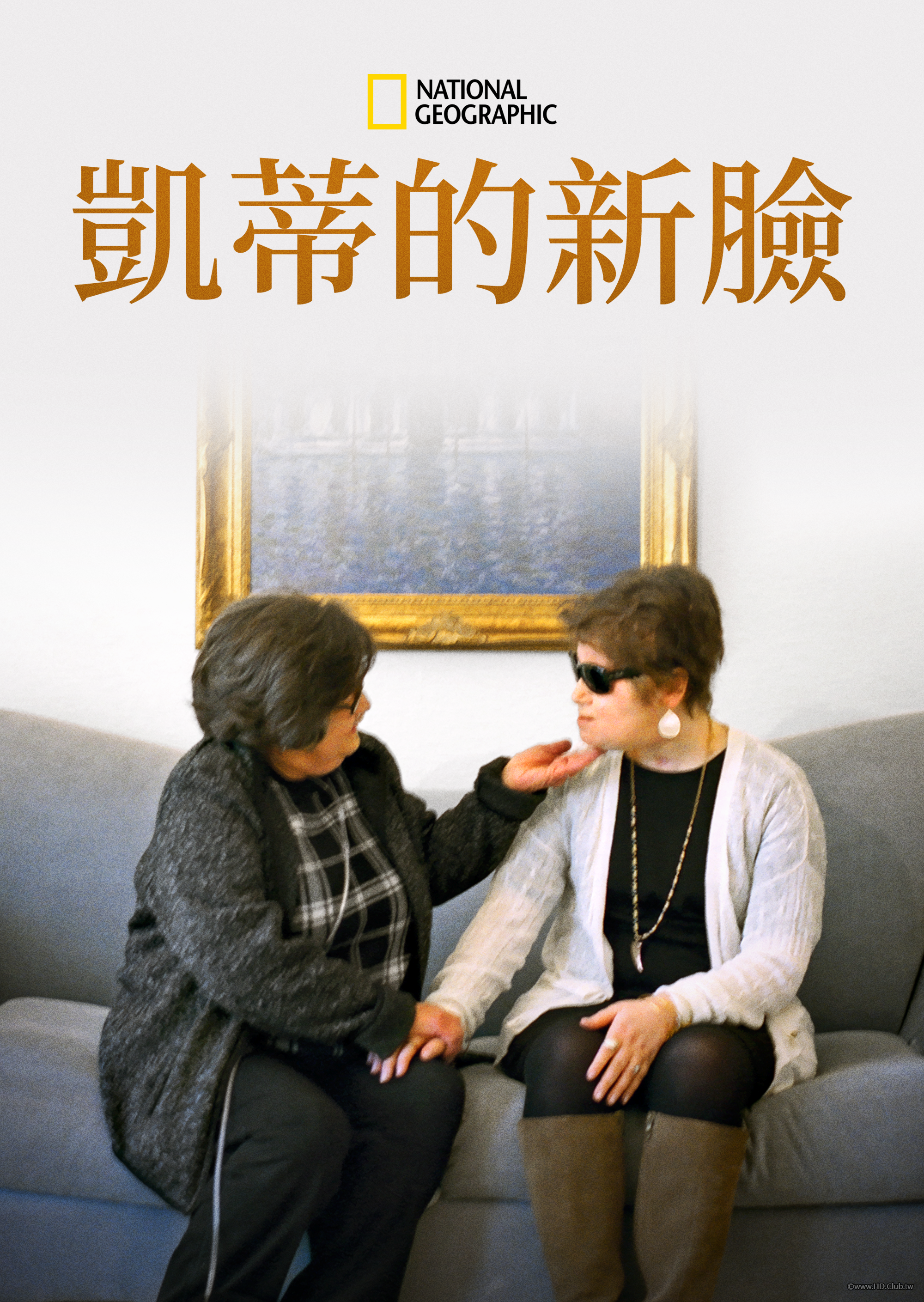 Katie&#039;s New Face：A Family&#039;s Journey(凱蒂的新臉).png